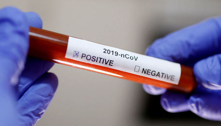 В Новосибирске зафиксирован второй заболевший коронавирусом