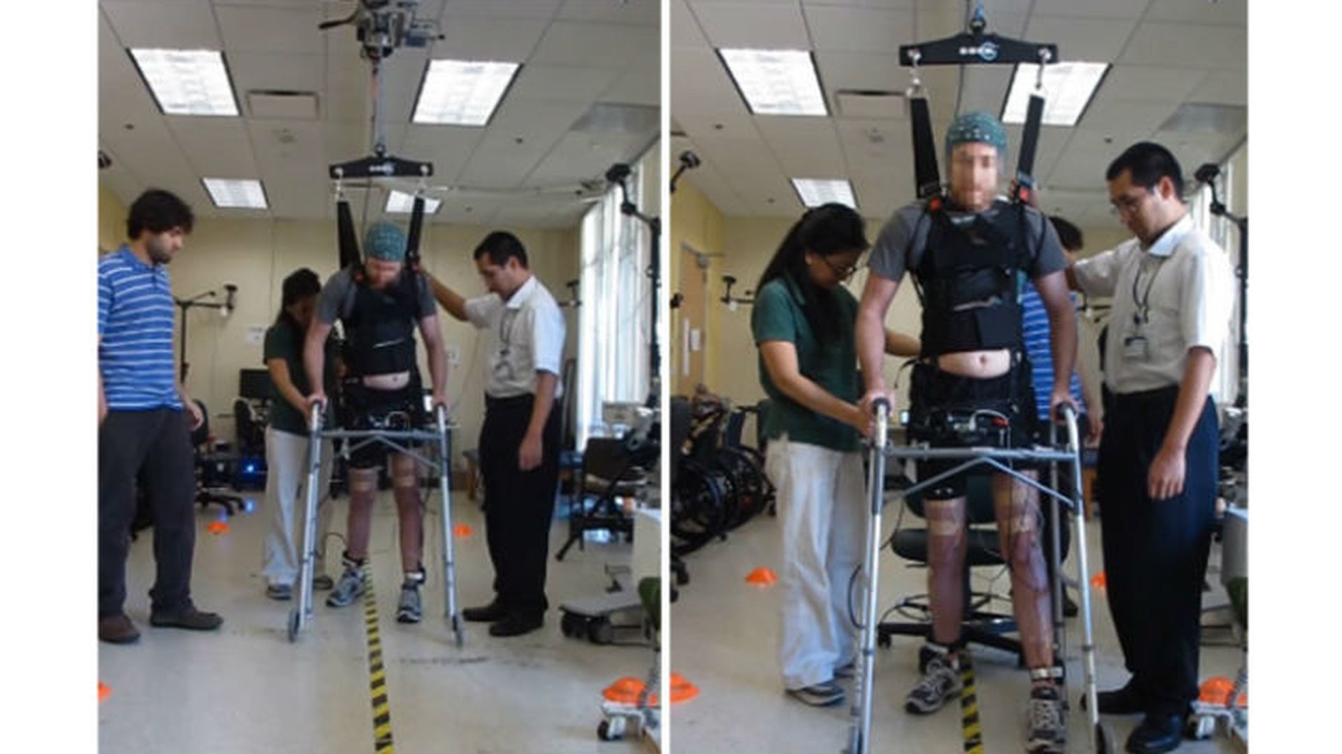 Операции при дцп. Тренажеры для реабилитации после инсульта. Тренажер для нижних конечностей. Ноги парализованных людей. Люди с параличом нижних конечностей.