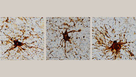 Глиальные клетки продолжают расти после смерти мозга.