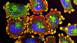 Наш иммунитет: прирождённые убийцы охотятся на раковые клетки