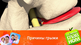 Все, что нужно знать о грыже брюшной полости и не только