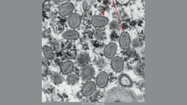 Два вириона оспы обезьян. Изображение получено с помощью электронного микроскопа.
