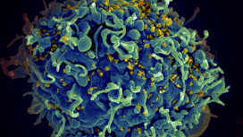 Пересадка стволовых клеток спасла от ВИЧ ещё одного пациента