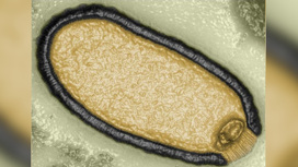 Улучшенная микрофотография вируса из вечной мерзлоты, получившего название Pithovirus Sibericum.