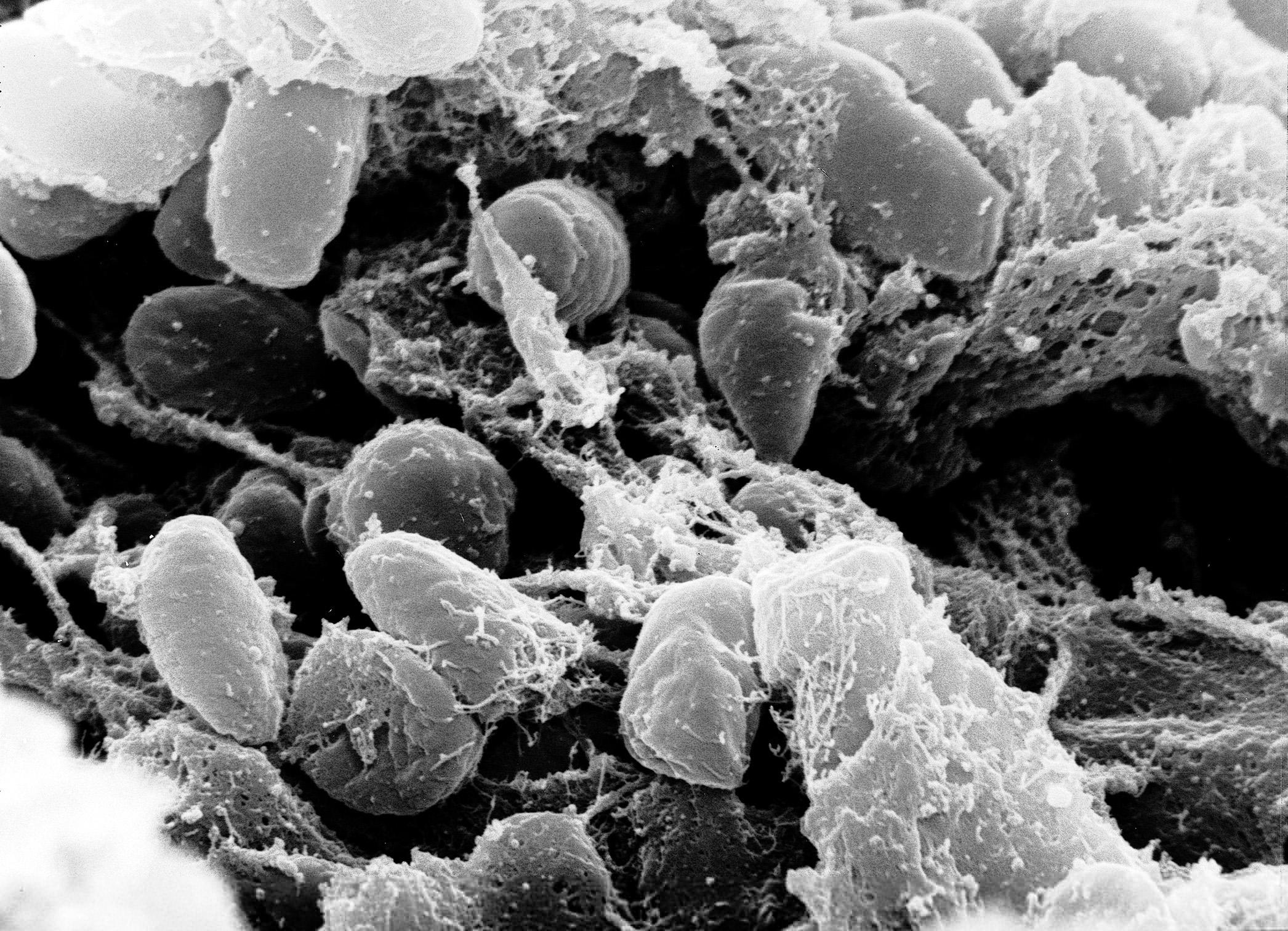 Бактерия вида Yersinia pestis. Электронная микрофотография.