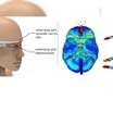 Слева: внешний вид нового устройства. Справа: электрические поля, которые оно должно возбуждать в мозге согласно результатам моделирования.
