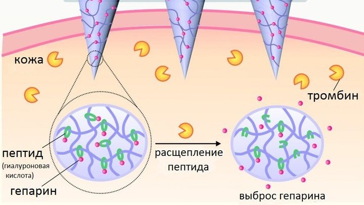 Чем выше уровень тромбина в крови, тем большую дозу гепарина "выбрасывает" пластырь в ответ.