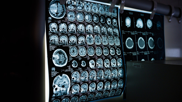 Уникальная база данных о головном мозге была собрана усилиями сотен учёных со всего мира.