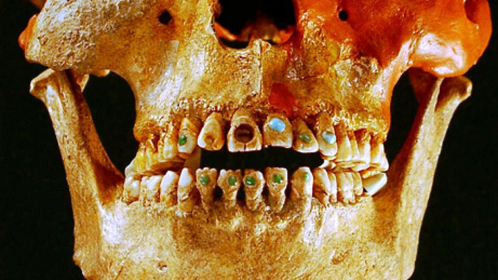 Майя часто выбирали нефрит и бирюзу для украшения зубов.